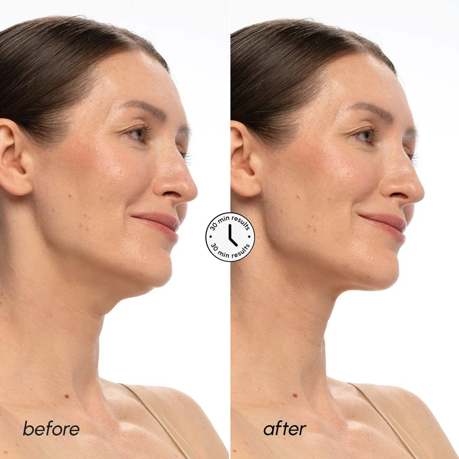 PDRN V-line Lifting Mask