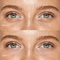 Pink Eye Patches for Puffy Eyes