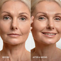 24K Gold V-Line Lifting Mask (pack of 5)