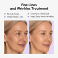 Anti-wrinkle Tape Patches